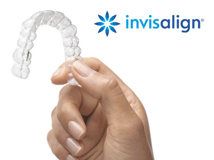 Invisalign Invisalign